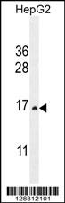 Rabbit anti CST9 Polyclonal Antibody C term Absin 优宁维 univ 商城