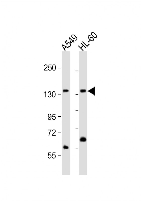 Rabbit anti AFF1 Polyclonal Antibody C term 爱必信 absin 官网