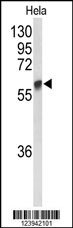 Rabbit Anti Galnt Polyclonal Antibody N Term Absin Univ