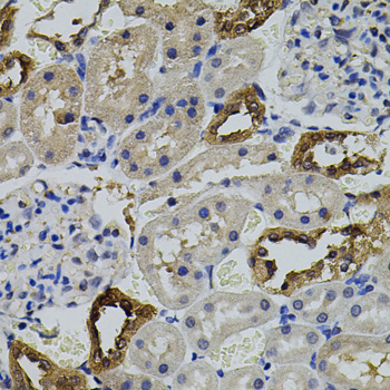 Rabbit Anti Aurkc Polyclonal Antibody Absin Univ