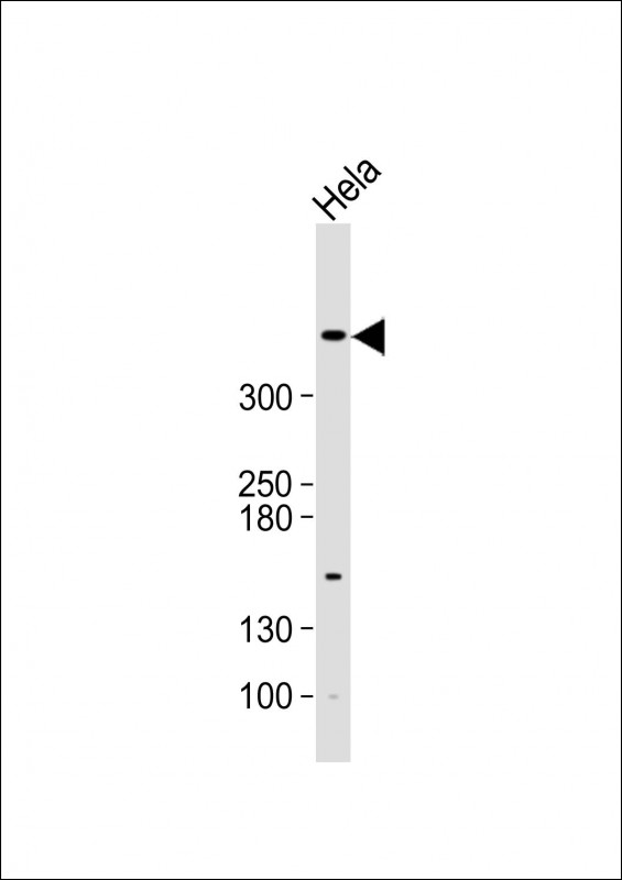 Rabbit Anti Atm Polyclonal Antibody N Term Absin Univ