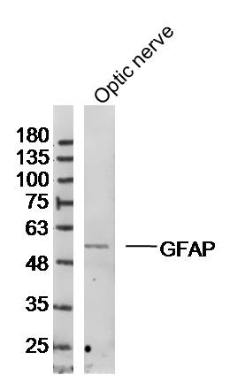 Rabbit anti GFAP Polyclonal Antibody Absin 优宁维 univ 商城