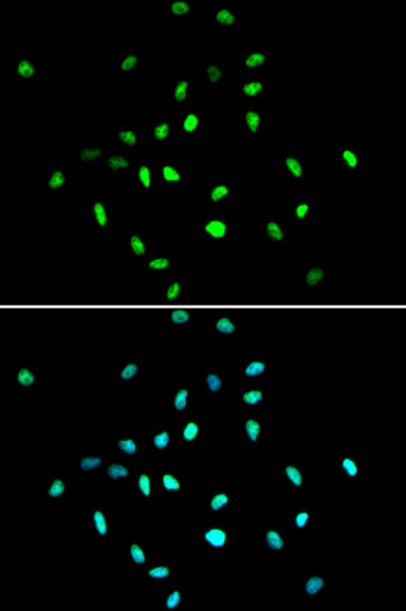 Rabbit Anti Hdac Polyclonal Antibody Absin Univ