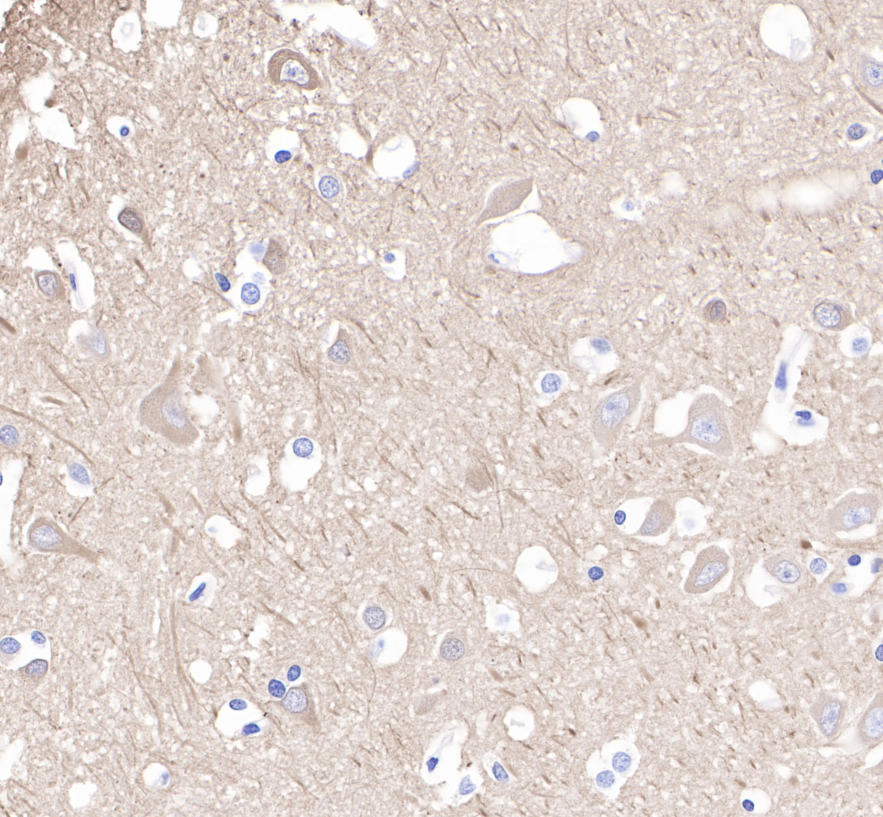 Rabbit anti-β-Tubulin Monoclonal Antibody