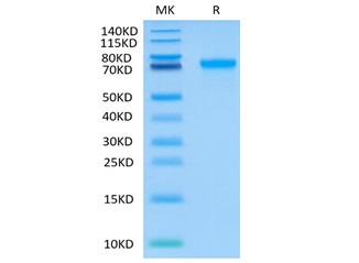 Recombinant Human LILRB2 Protein(C-His-Avi)