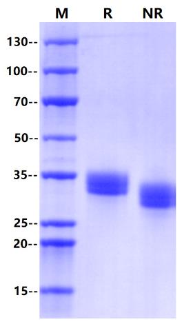 Recombinant Human PD-L1 Protein(C-6His)
