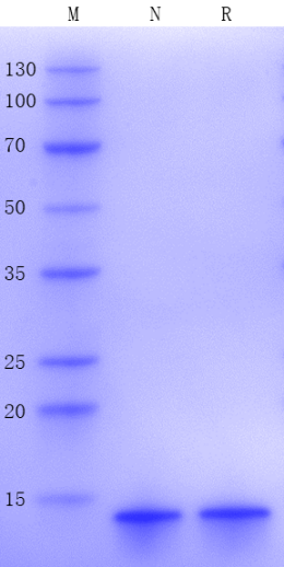 Recombinant Human NT-proBNP Protein(N-His)