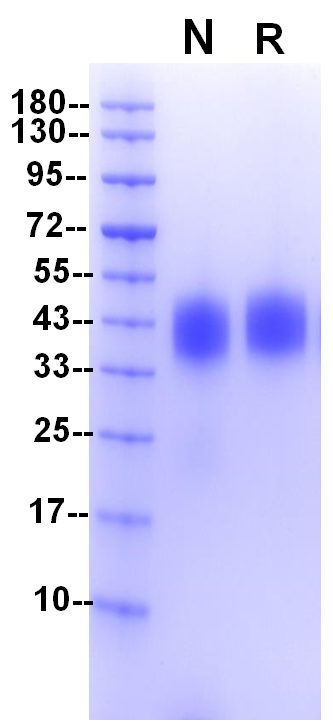 Recombinant Human Fc γ RIIIA(V176) Protein(C-10His)