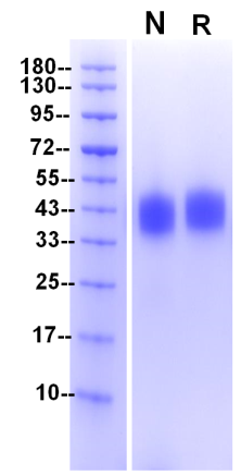 Recombinant Human Fc γ RIIIA(F176) Protein(C-10His)