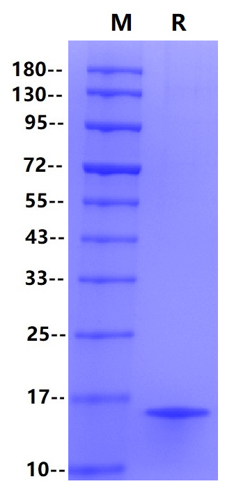 Recombinant Human PCT Protein(His Tag)