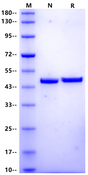 Recombinant Human cTnT Protein(N-6His)