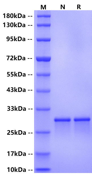 Recombinant Human cTnI Protein(N-6His)