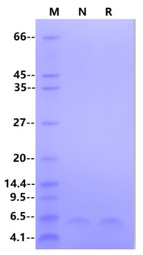 Recombinant HBV Surface Antigen-preS2 Protein
