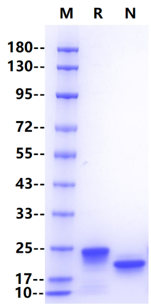 Recombinant Human RBP4 Protein(C-6His)