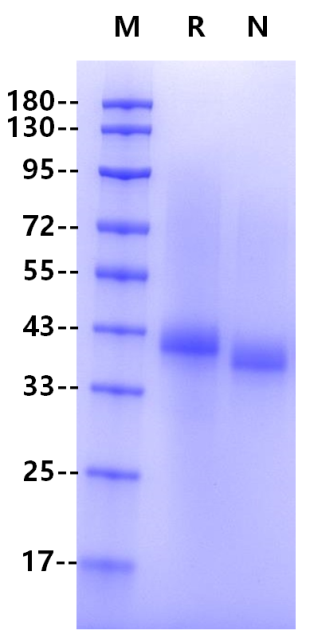 Recombinant Human CD23 Protein(N-10His)