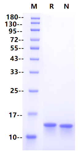 Recombinant Human β2-Microglobulin Protein(C-6His)