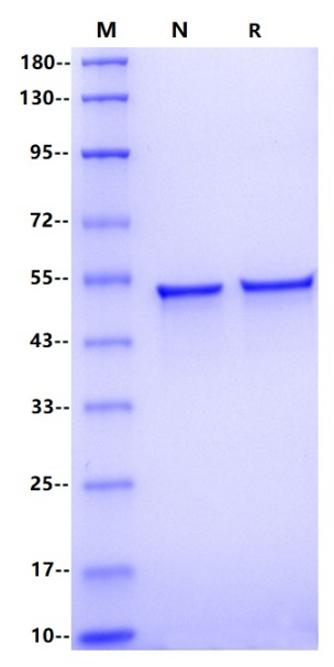 Recombinant SARS-CoV-2 Nucleocapsid Protein(C-10His)