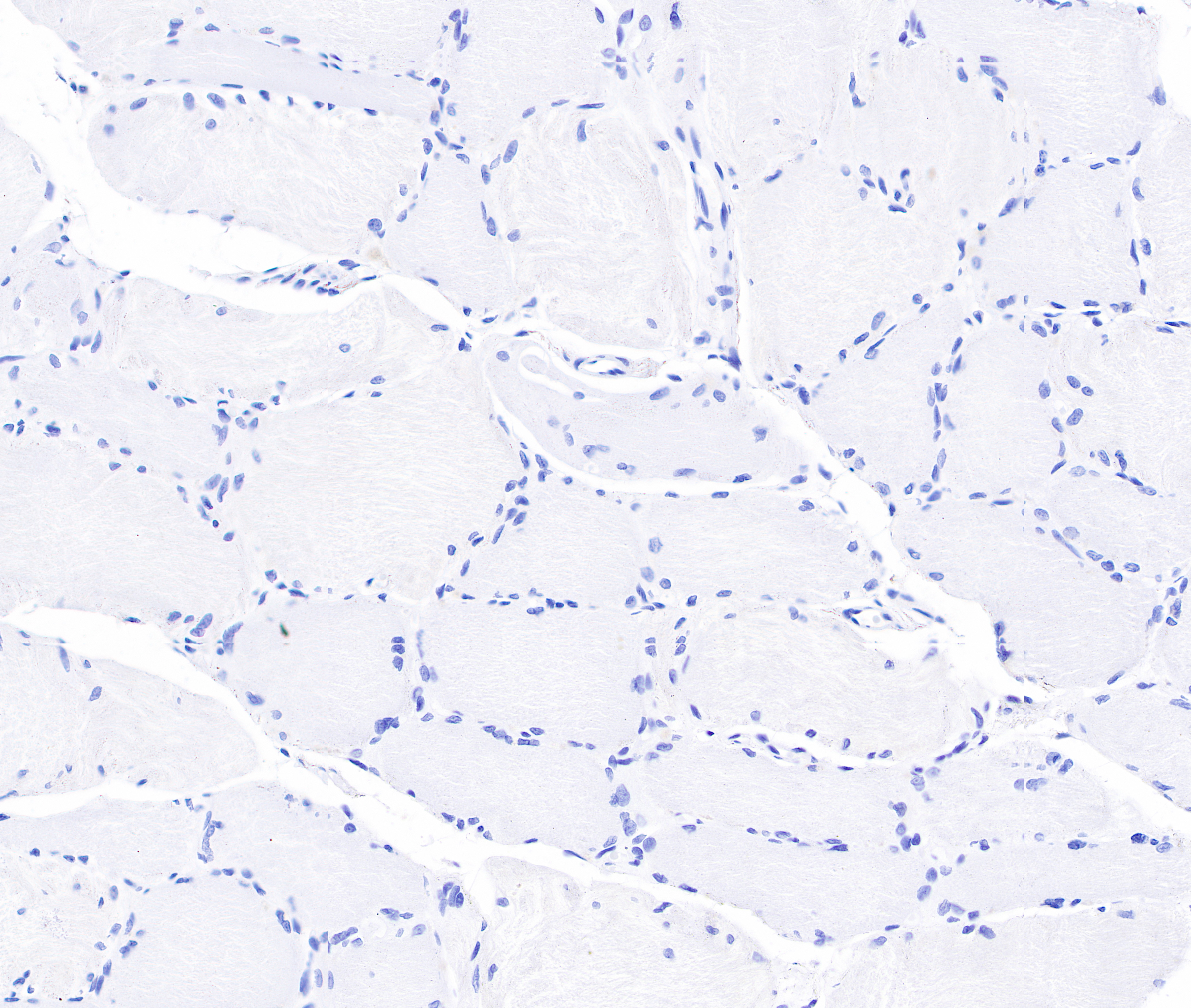 Rabbit anti-Collagen VI Recombinant Monoclonal Antibody(S-1495-18)