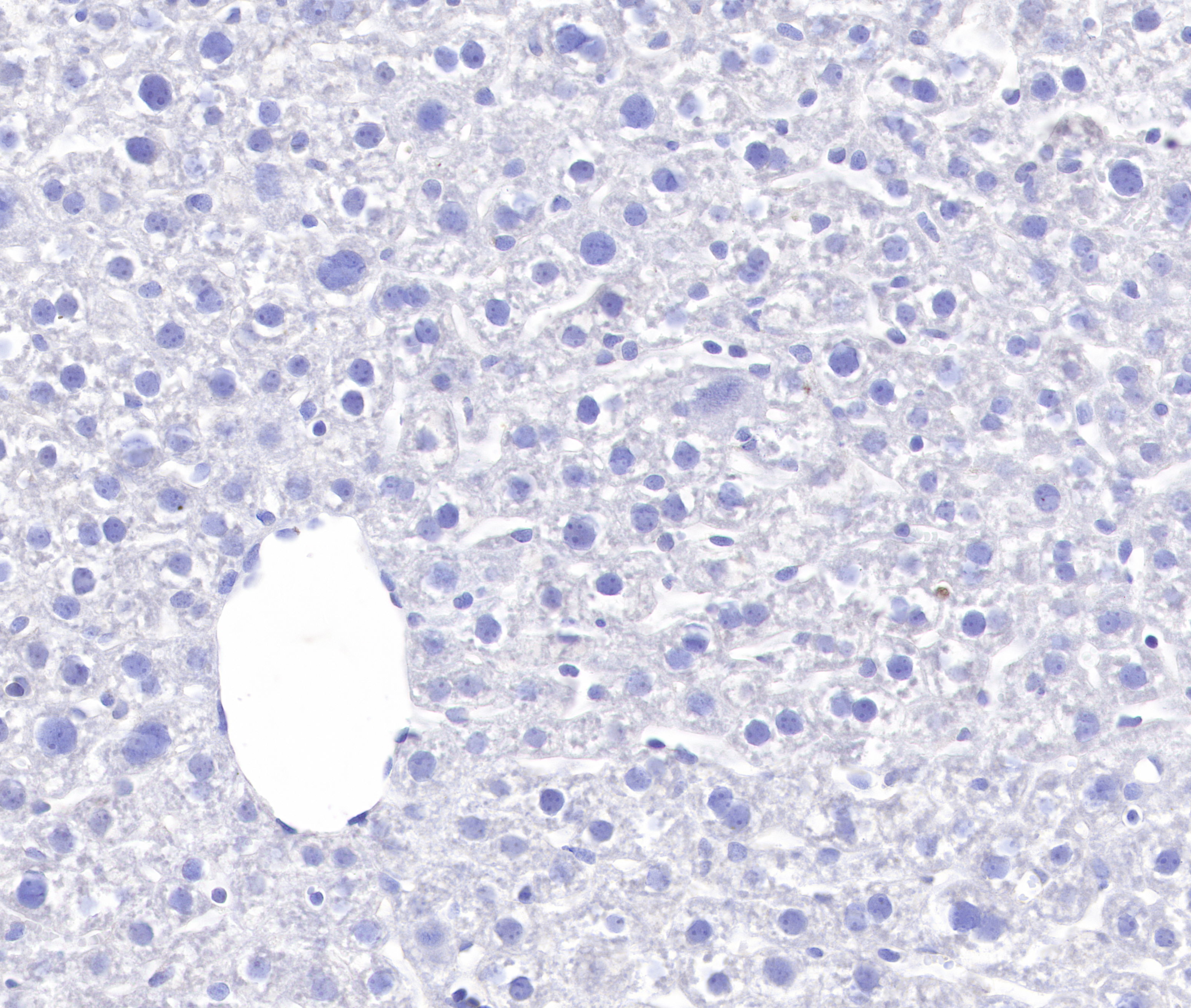 Rabbit anti-Collagen VI Recombinant Monoclonal Antibody(S-1495-18)