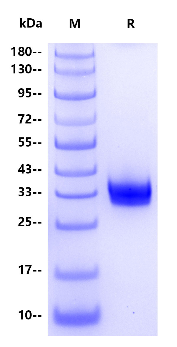 Recombinant SARS-CoV-2 Omicron(BA.2.12.1) RBD Protein(C-10His)