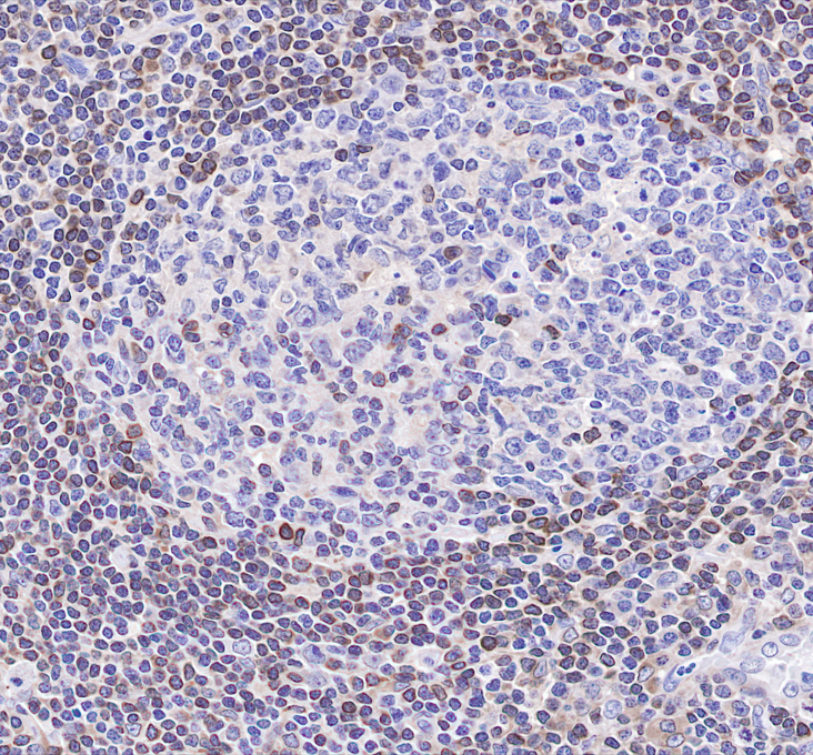 Rabbit anti-Bcl-2 Recombinant Monoclonal Antibody(005-24)