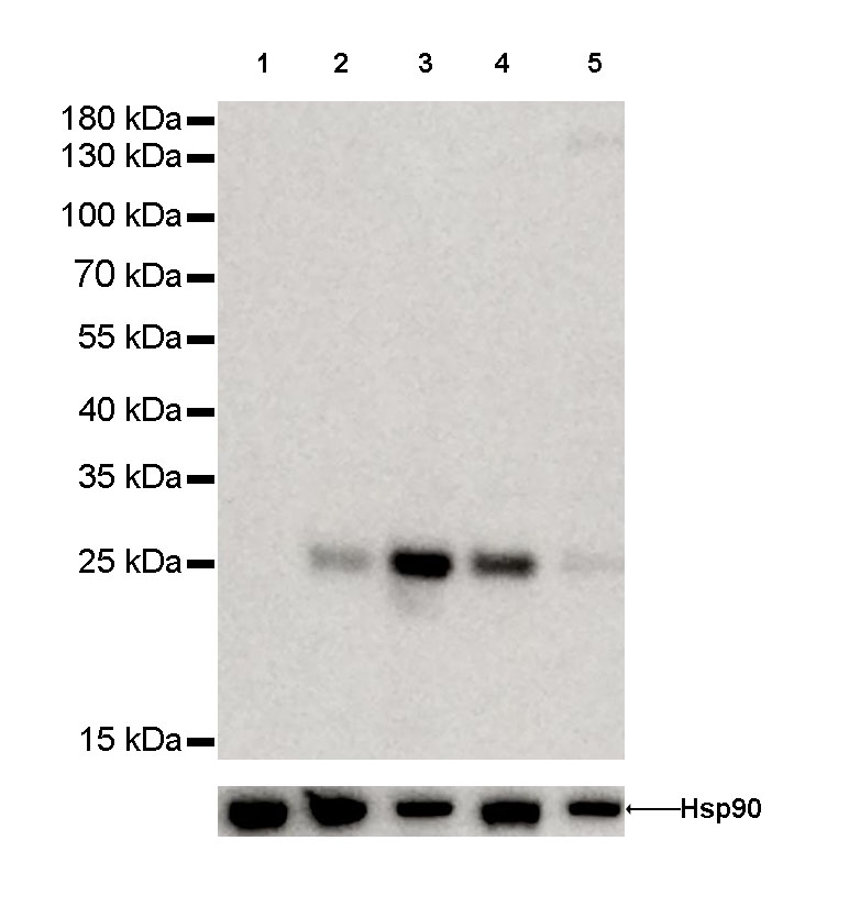 Rabbit anti-Bcl-2 Recombinant Monoclonal Antibody(005-24)