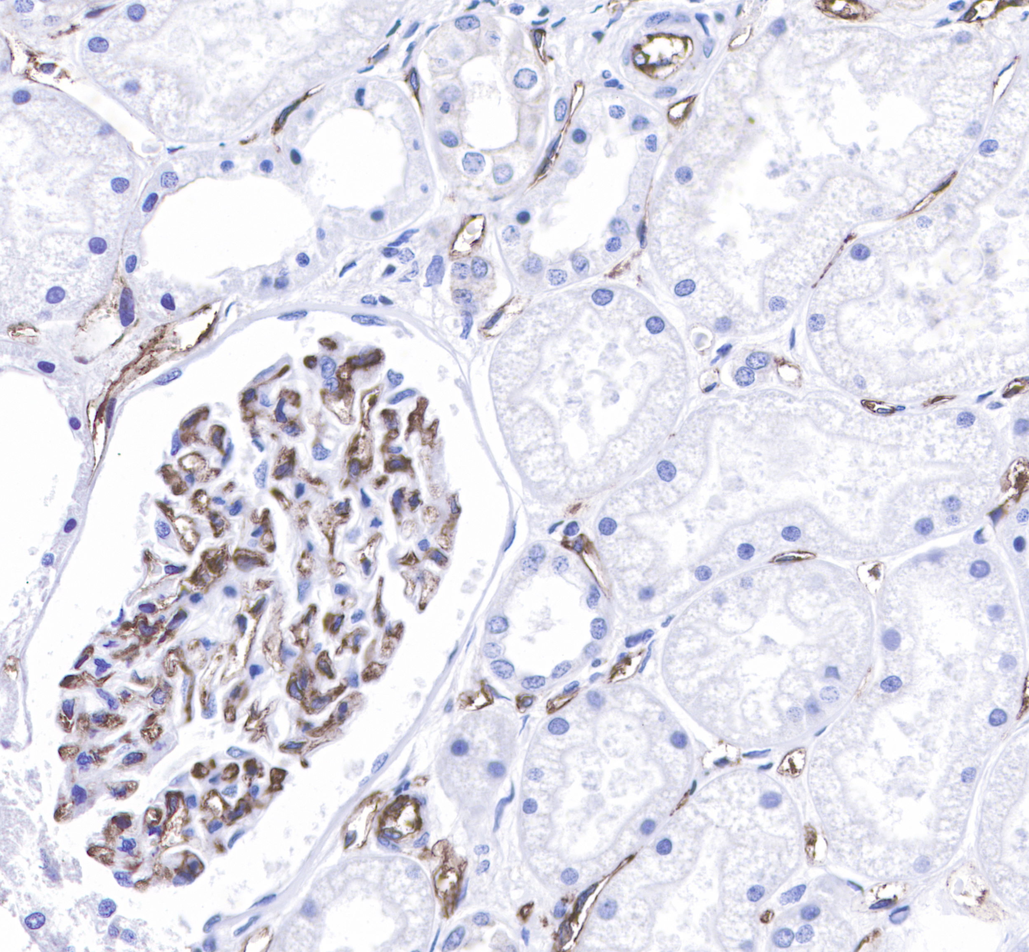 Rabbit anti-CD31 Monoclonal Antibody(008-17)
