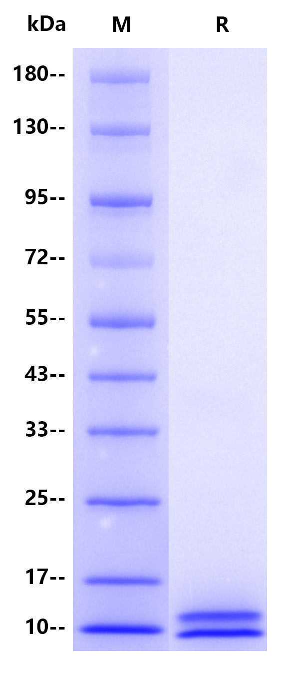 Recombinant Human PTH Protein(C-10His)