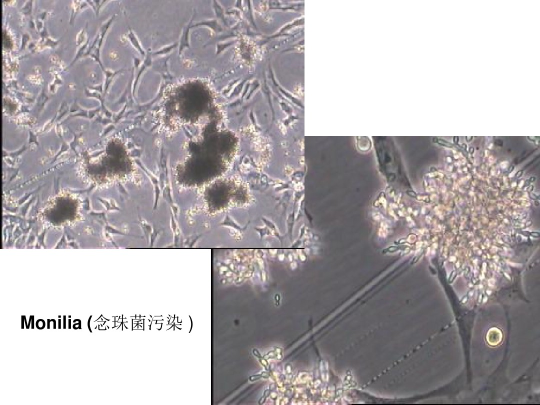 一闪一闪亮晶晶显微镜下CHO细胞培养与被杂菌污染过程延时摄影_哔哩哔哩_bilibili