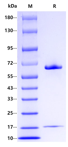 Recombinant Human PCSK9 Protein(His Tag)
