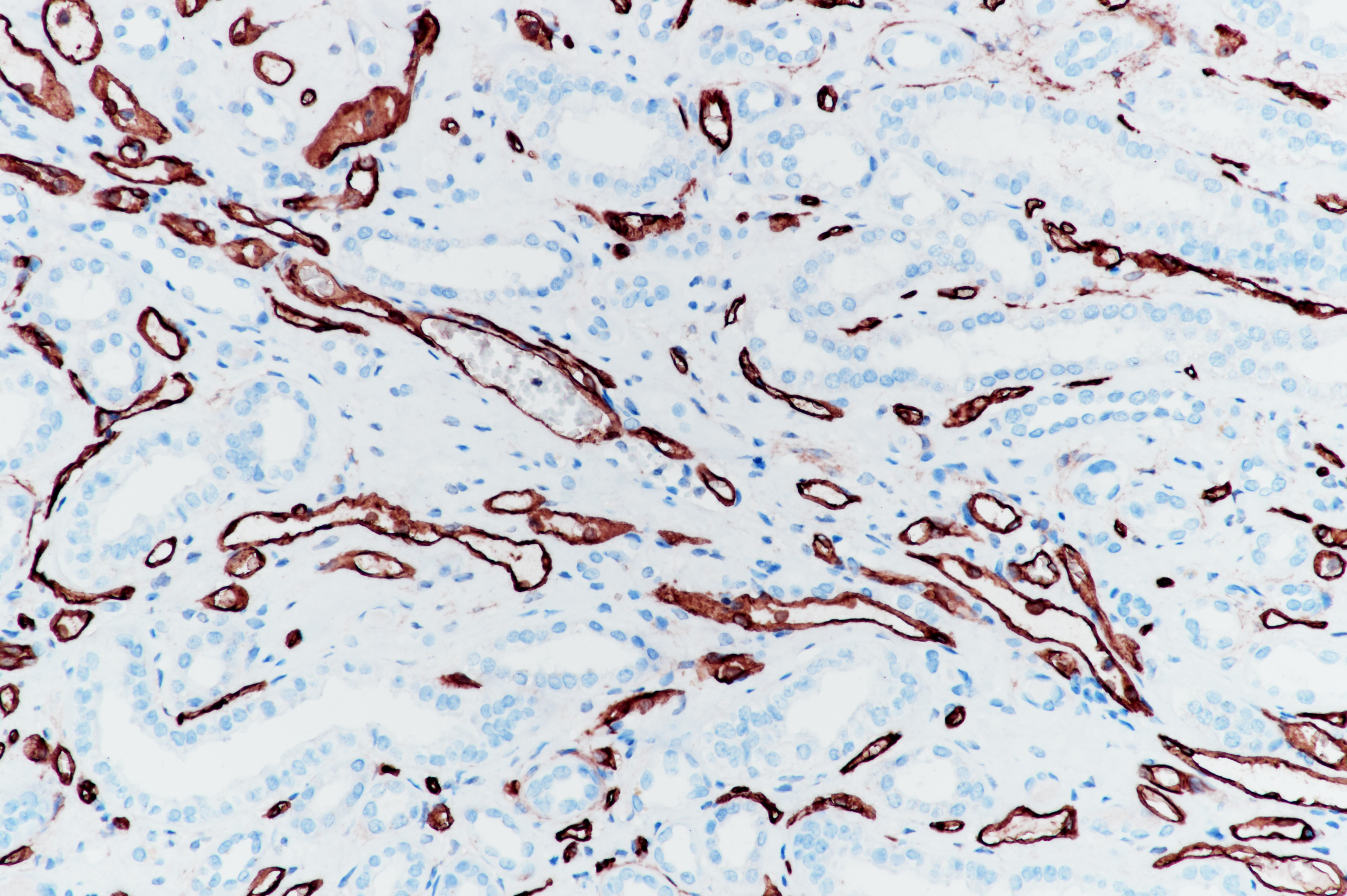 Rabbit anti-CD34 Monoclonal Antibody