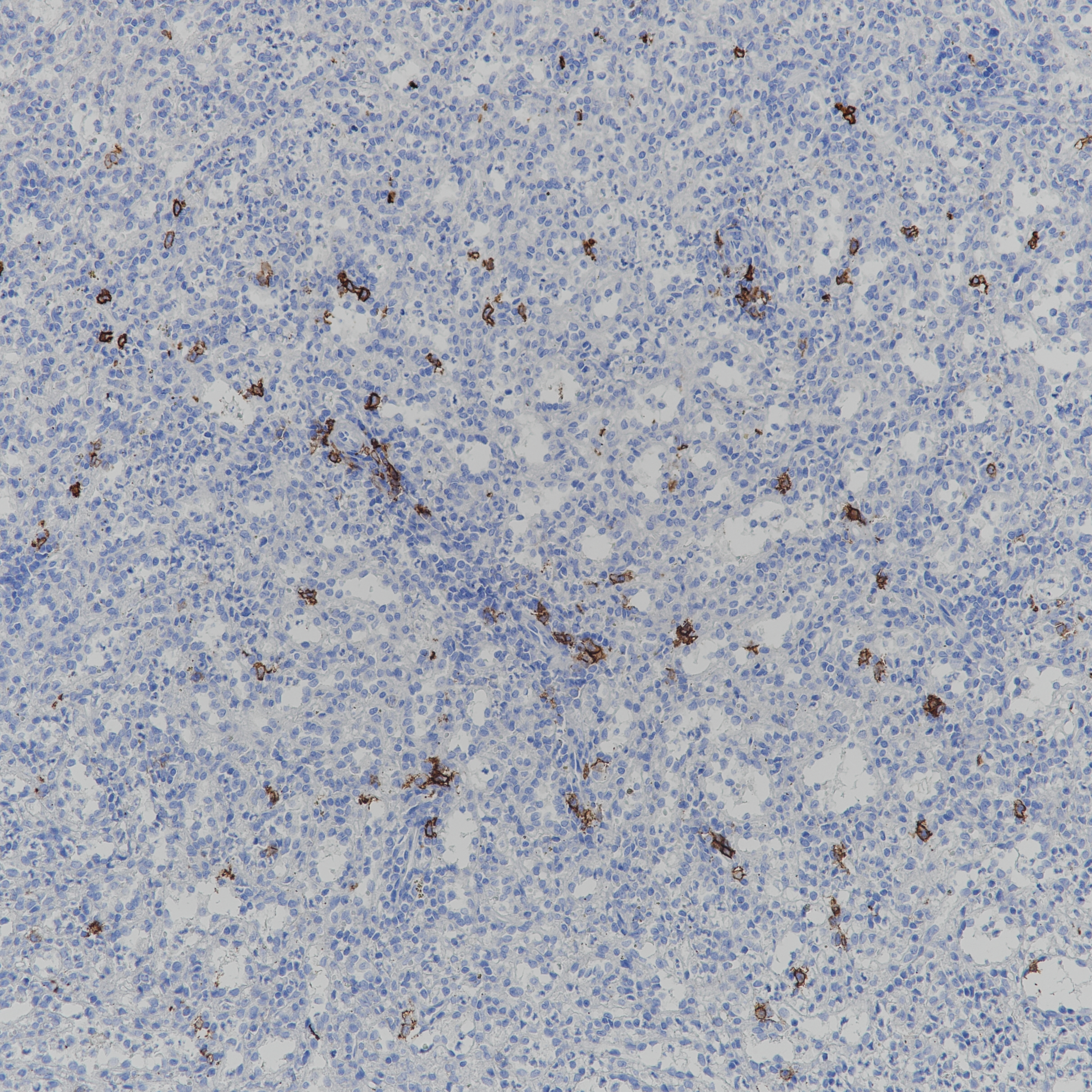Rabbit anti-CD38 Monoclonal Antibody