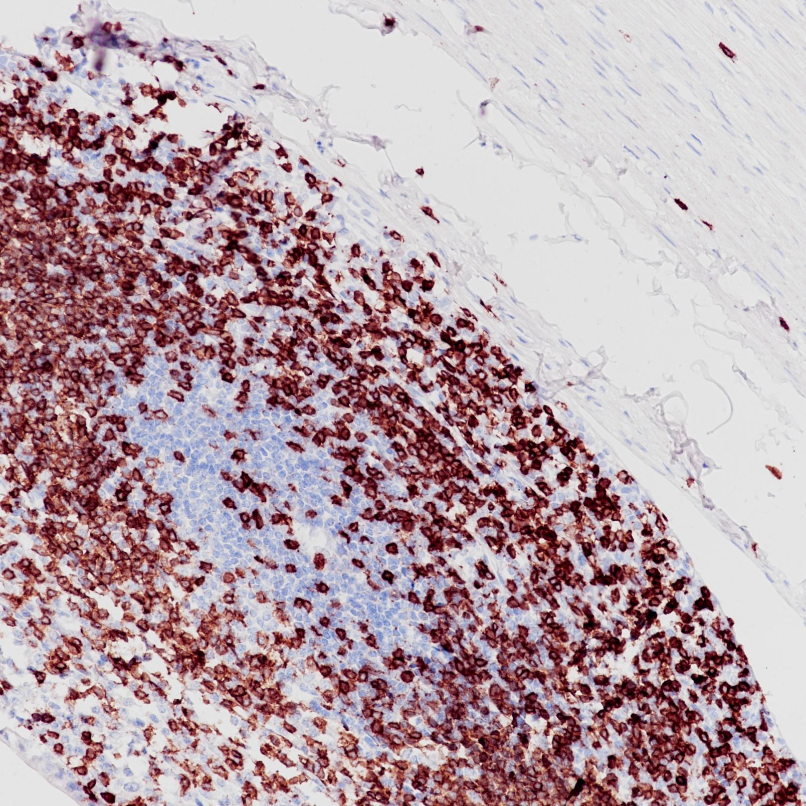 Rabbit anti-CD3 Monoclonal Antibody