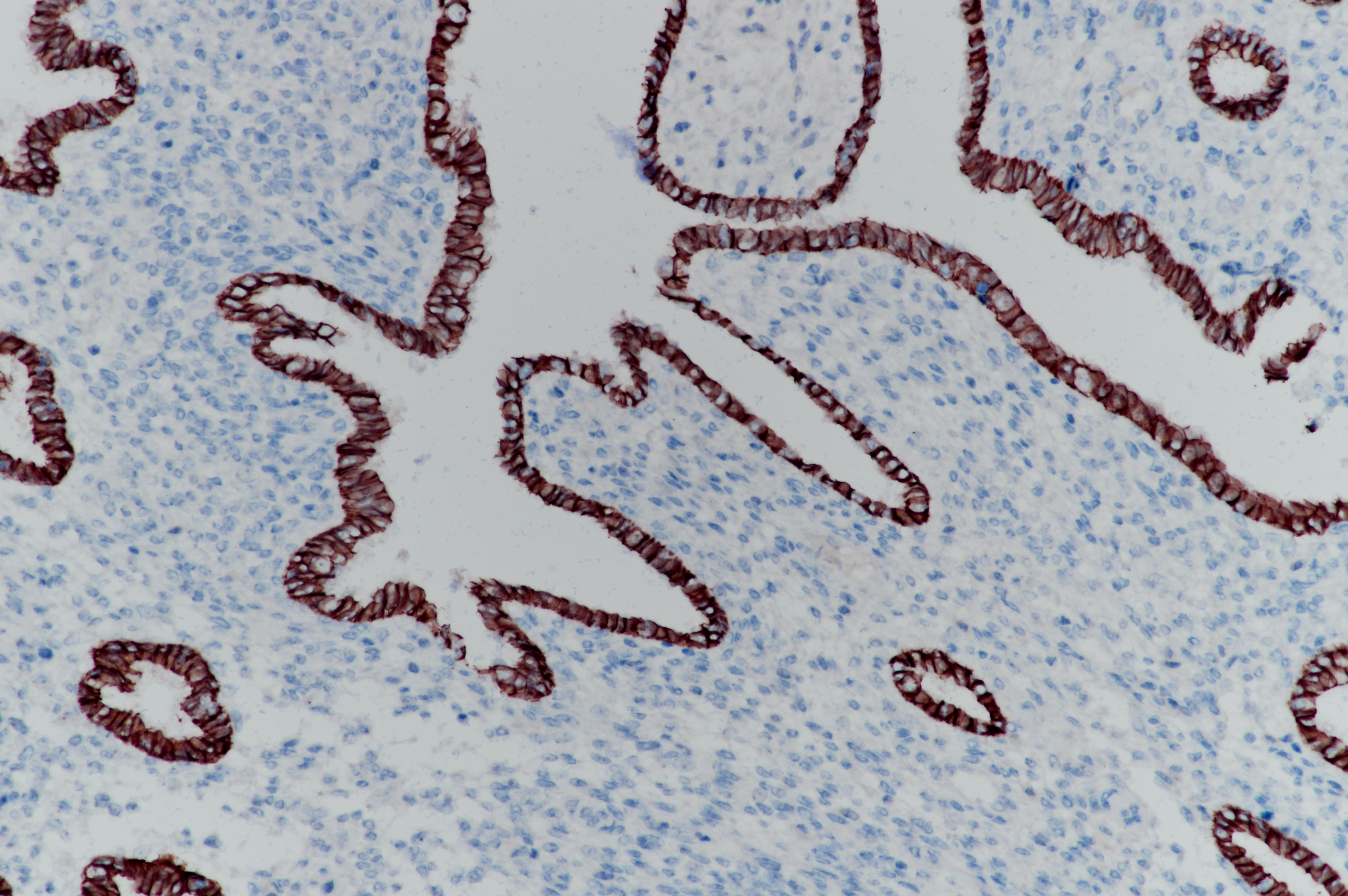 Rabbit anti-E-Cadherin Monoclonal Antibody