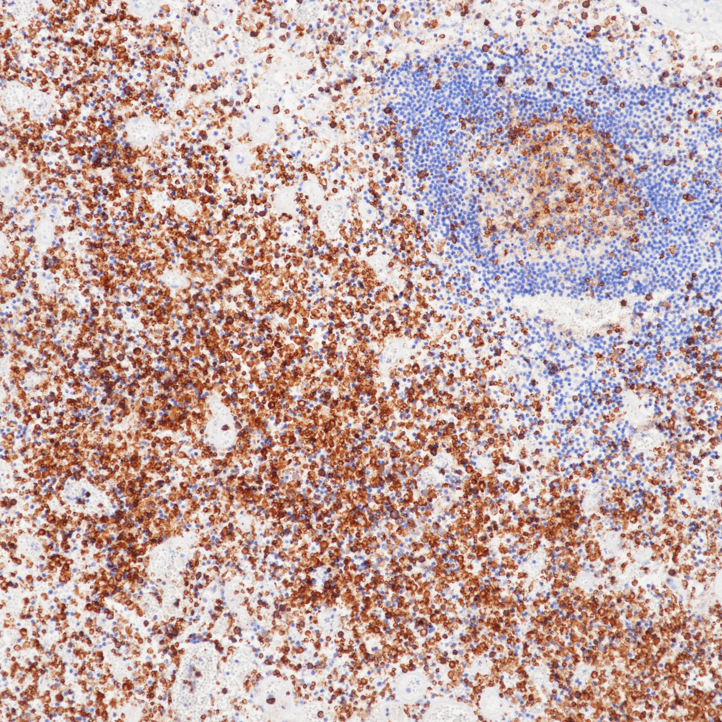 Rabbit anti-CD4 Monoclonal Antibody