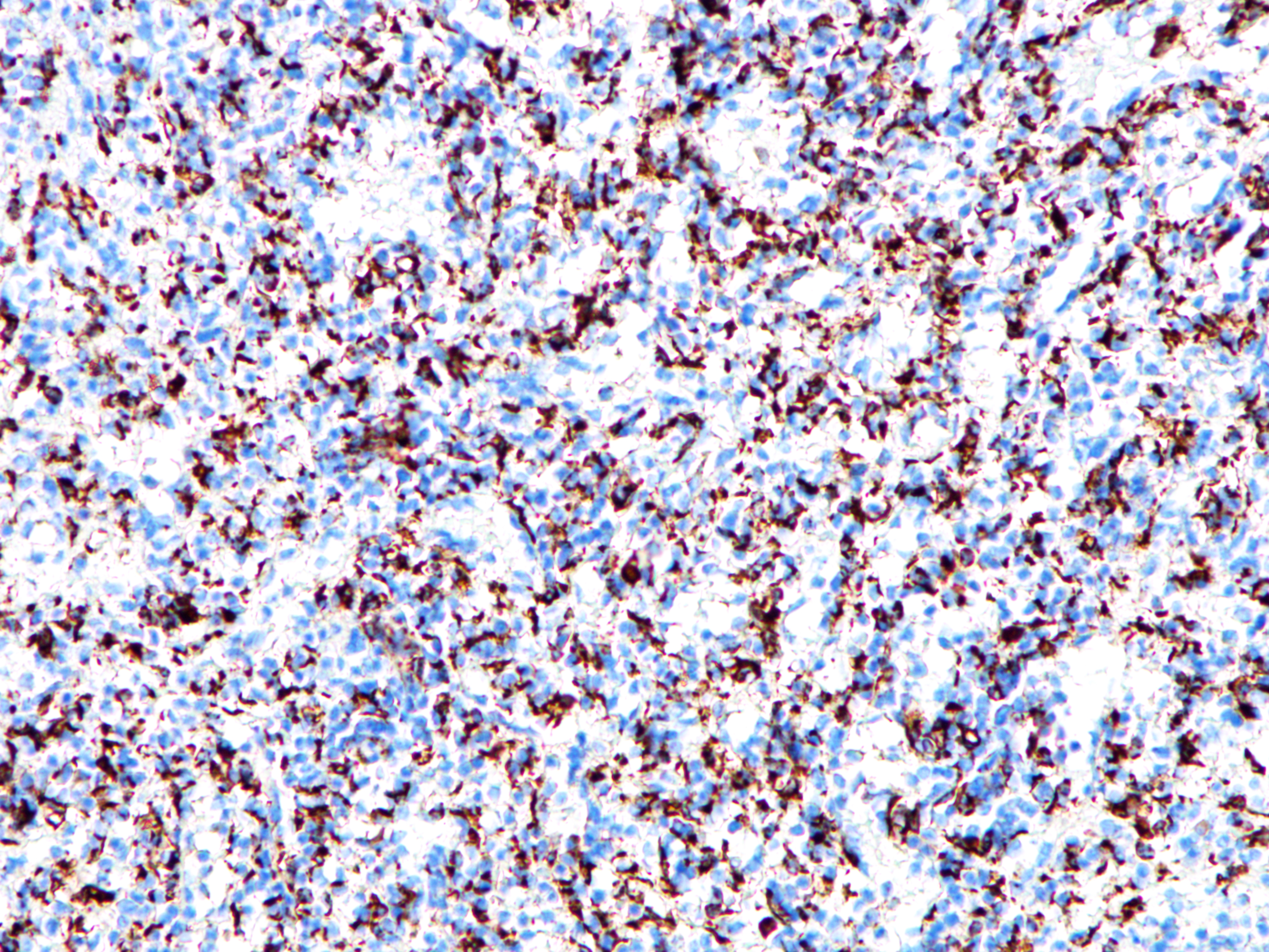 Rabbit anti-CD68 Monoclonal Antibody