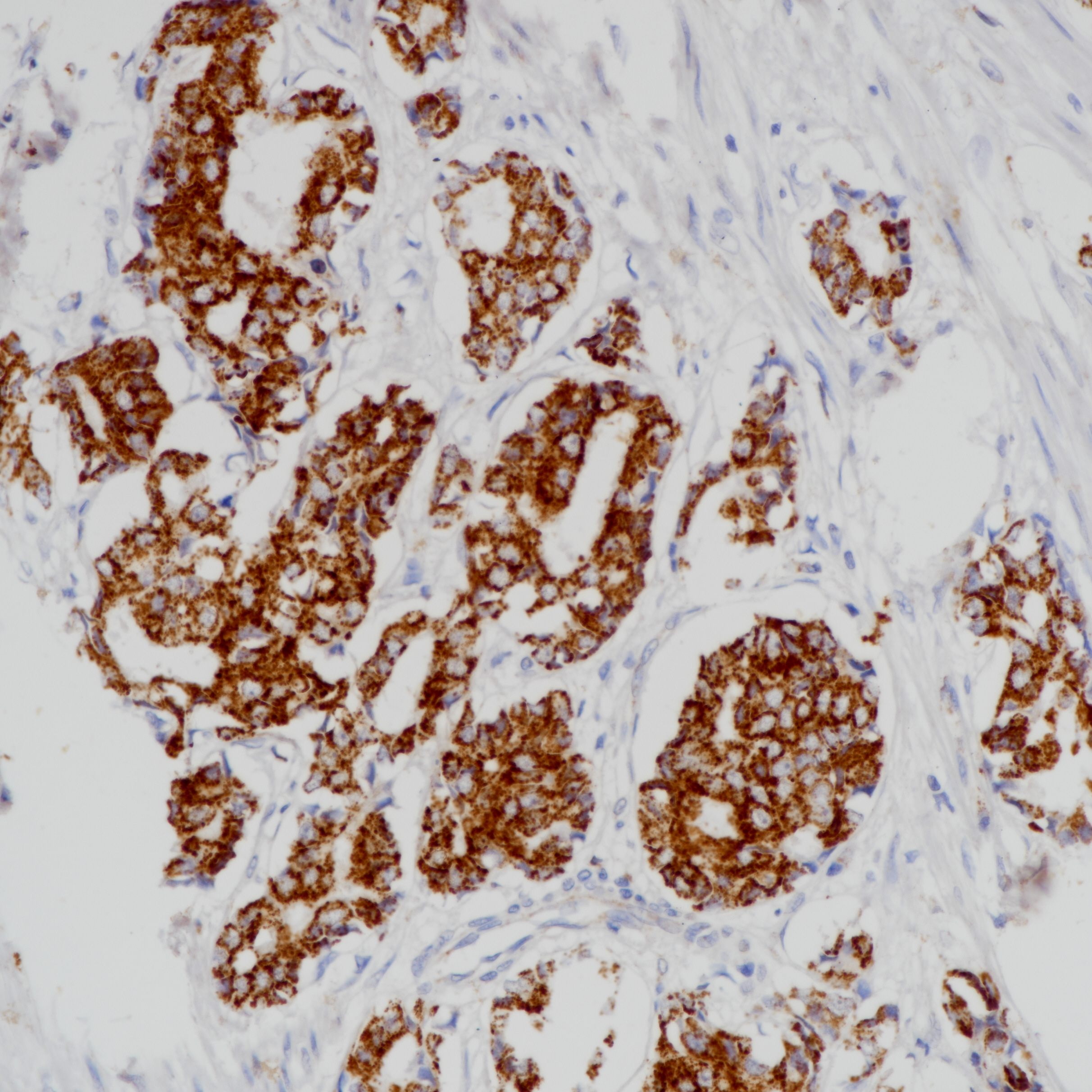 Mouse anti-AMACR Monoclonal Antibody