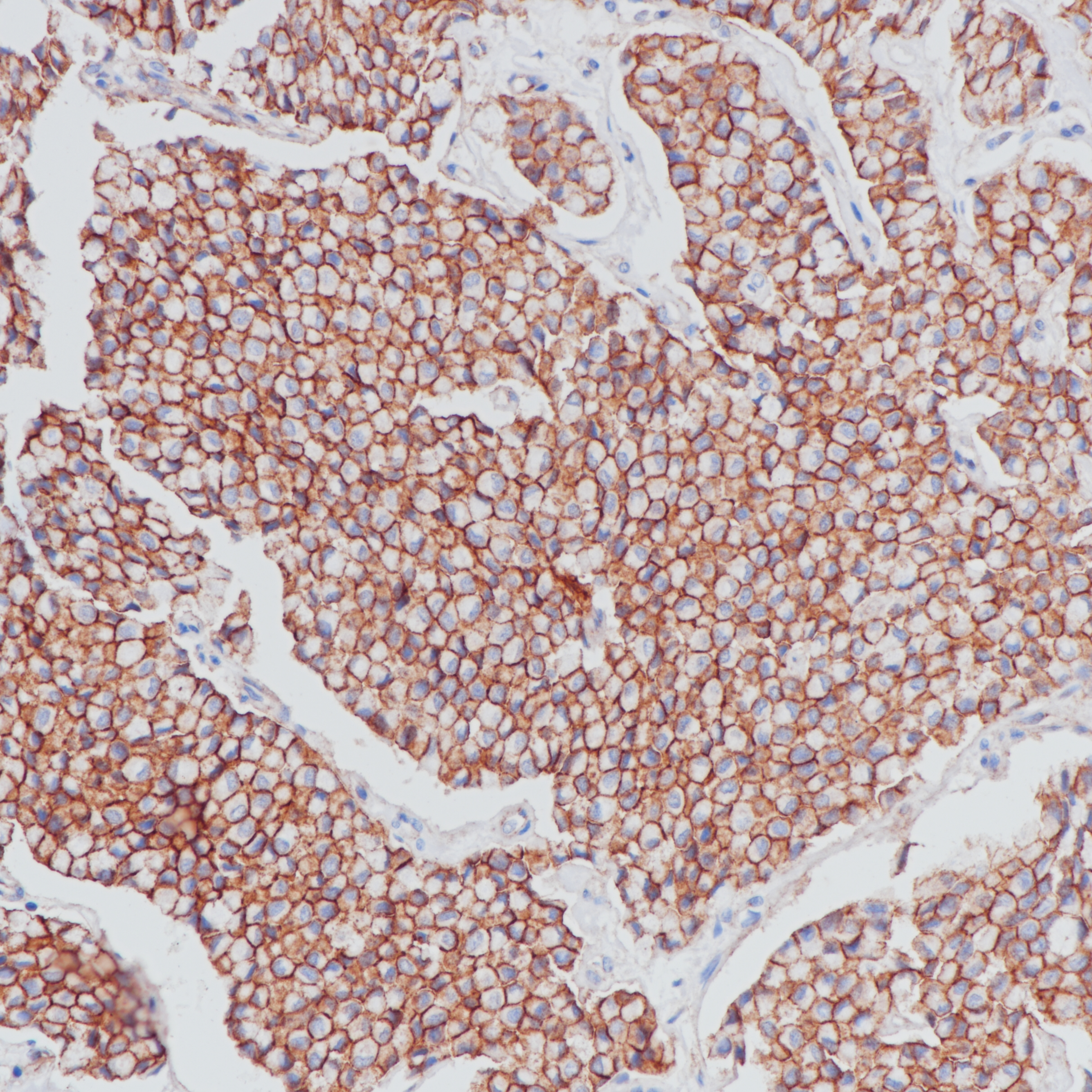 Rabbit anti-Beta-Catenin Monoclonal Antibody
