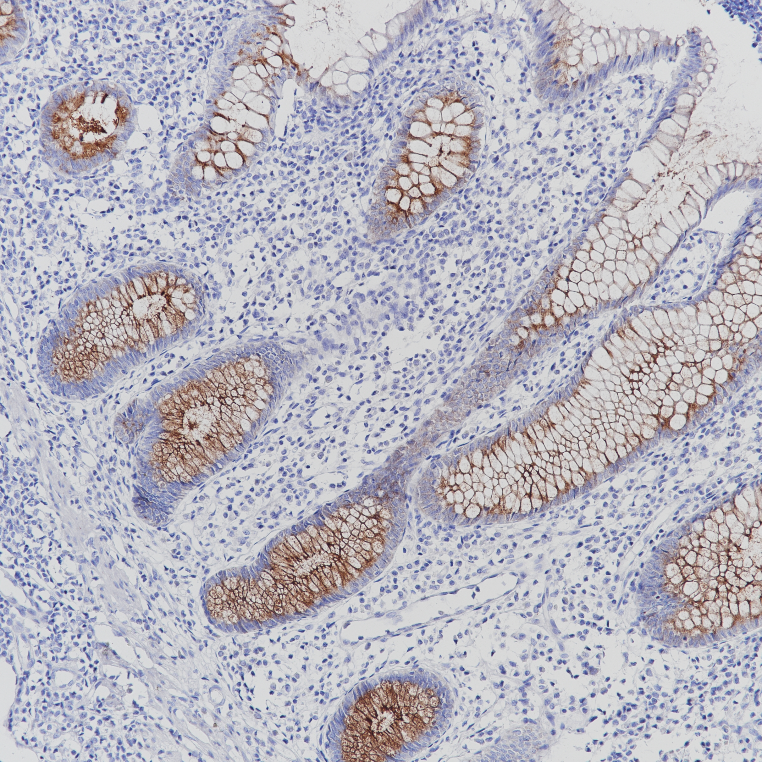 Rabbit anti-MUC4 Monoclonal Antibody