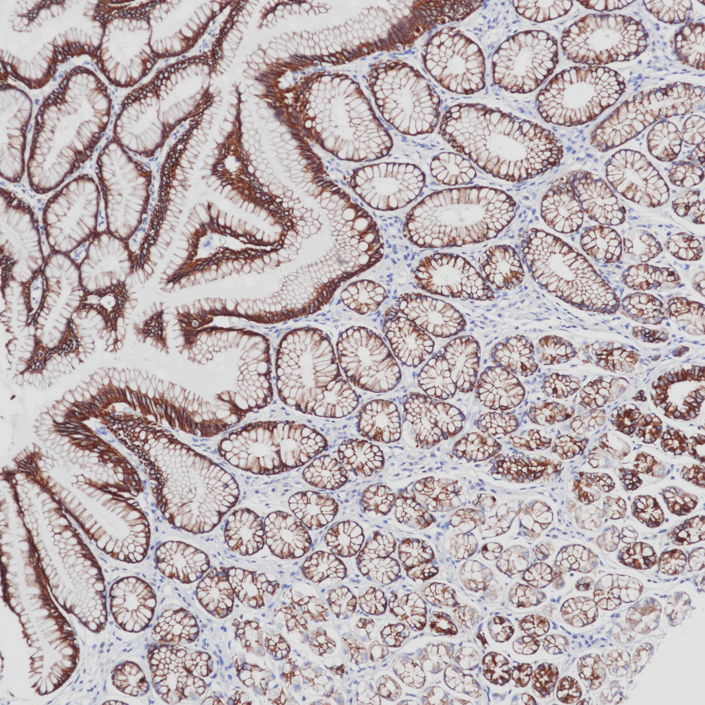Mouse anti-Cytokeratin Pan Monoclonal Antibody