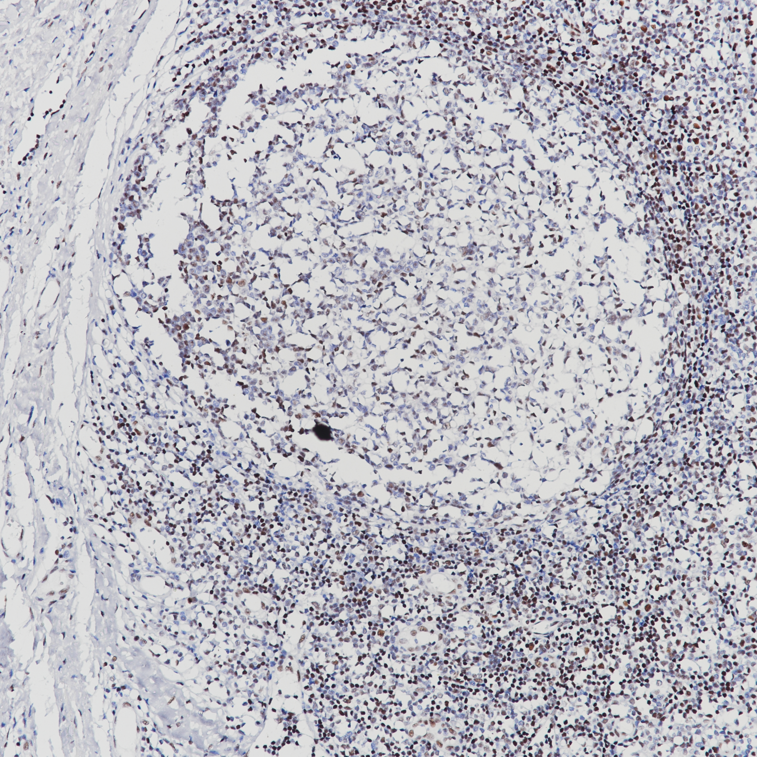 Rabbit anti-FOXP1 Monoclonal Antibody