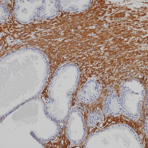 Mouse anti-Actin(Smooth Muscle) Monoclonal Antibody