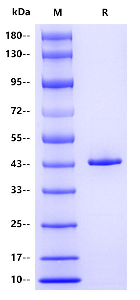 Recombinant HRSV Nucleoprotein Protein(C-10His)