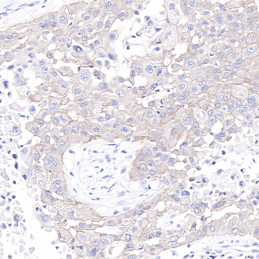 Rabbit anti-c-Met Recombinant Monoclonal Antibody(009-7H0L0)