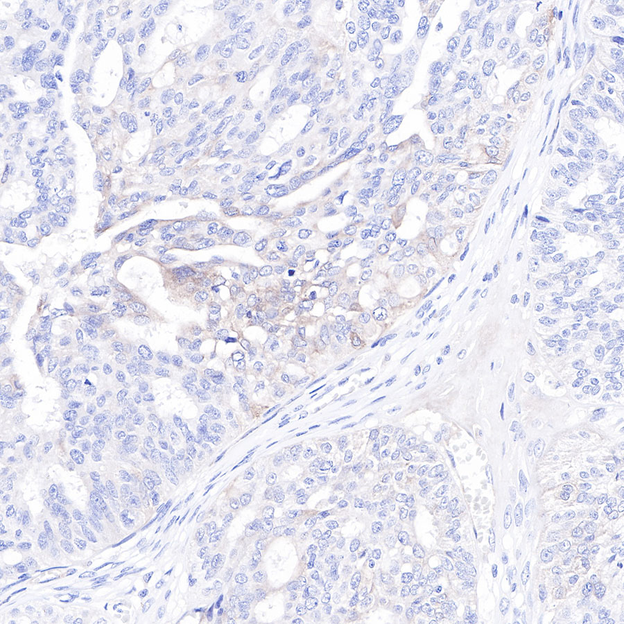 Rabbit anti-c-Met Recombinant Monoclonal Antibody(009-7H0L0)