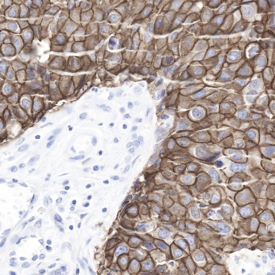 Rabbit anti-ErbB2 Recombinant Monoclonal Antibody(069-57)