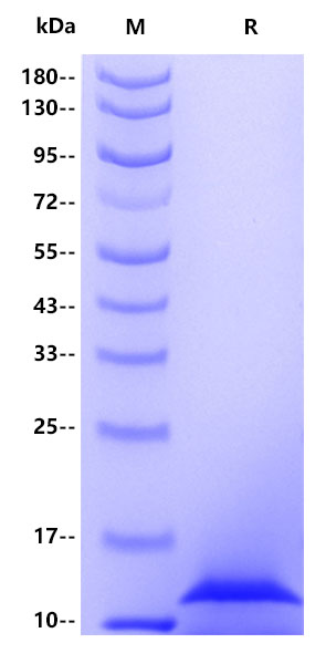 Recombinant Human Calprotectin(S100A8) Protein(C-10His)