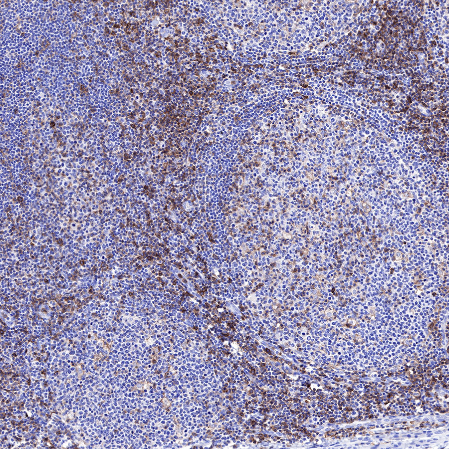 Rabbit anti-CD43 Recombinant Monoclonal Antibody(R101)