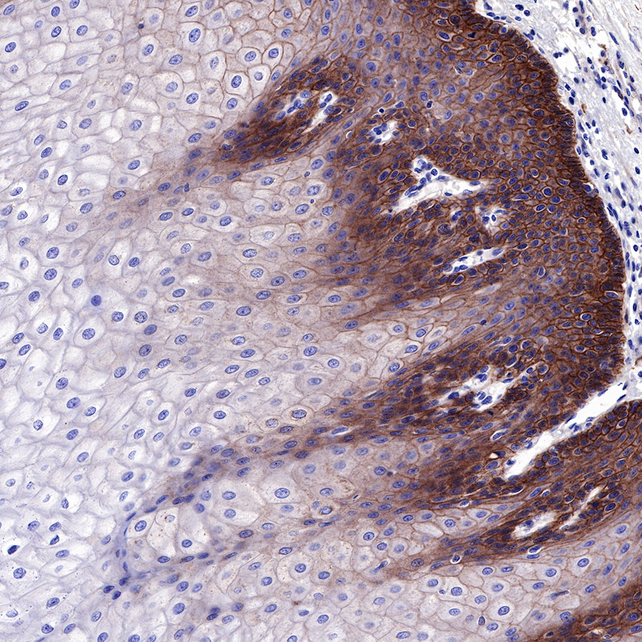 Rabbit anti-EGFR Recombinant Monoclonal Antibody(R110)