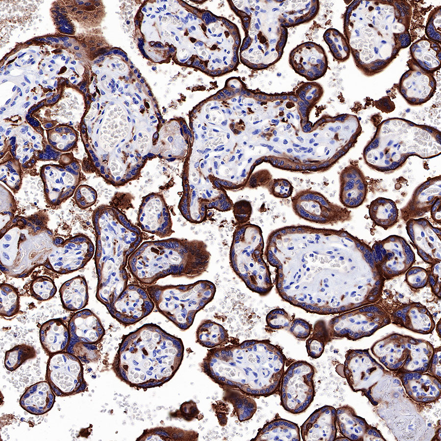 Rabbit anti-EGFR Recombinant Monoclonal Antibody(R110)
